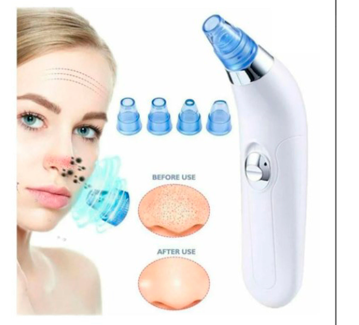 Extractor de Puntos Negros