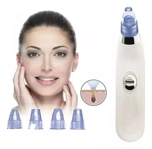 Extractor de Puntos Negros